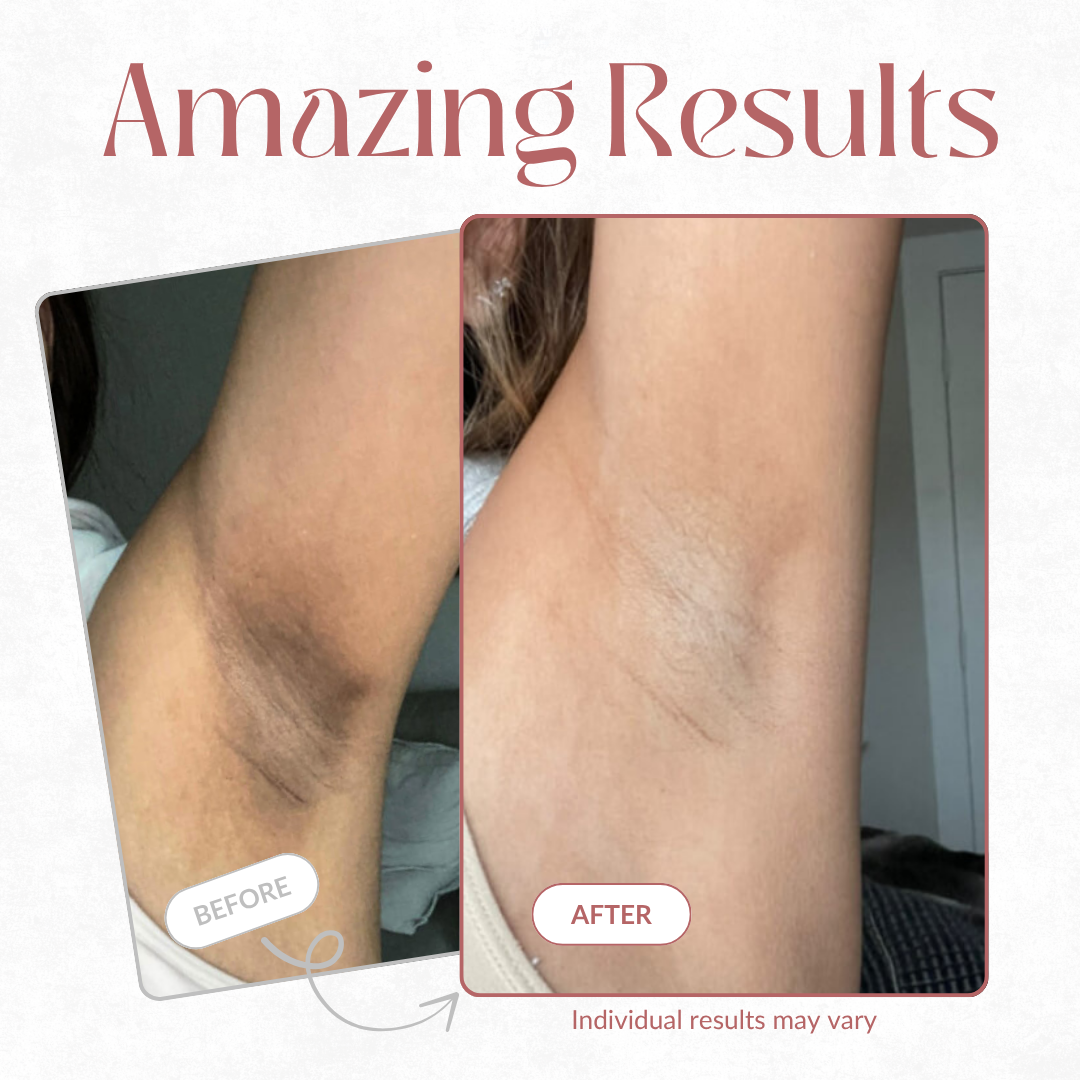 CocoBeauty Peel Shot | Kojic + Turmeric Exfoliating Spray – Radiant Skin, Simplified TARHUS Beauty & Personal Care