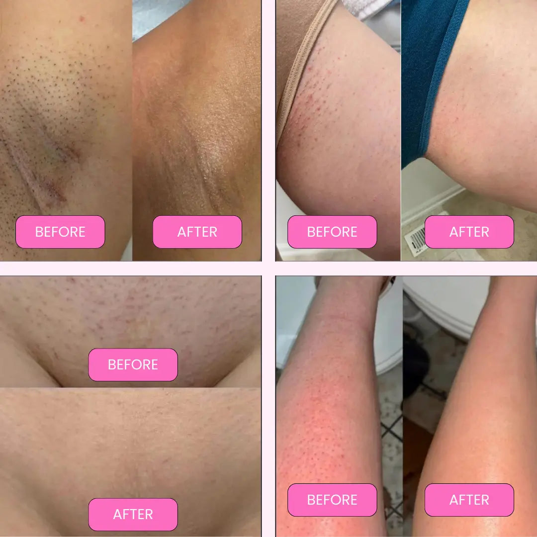 Electric Shaver | Close, Comfortable & Irritation-Free Grooming - TARHUS