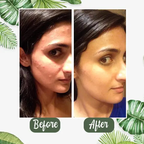 Diystar™  Green Tea Deep Cleanse Mask Stick - TARHUS