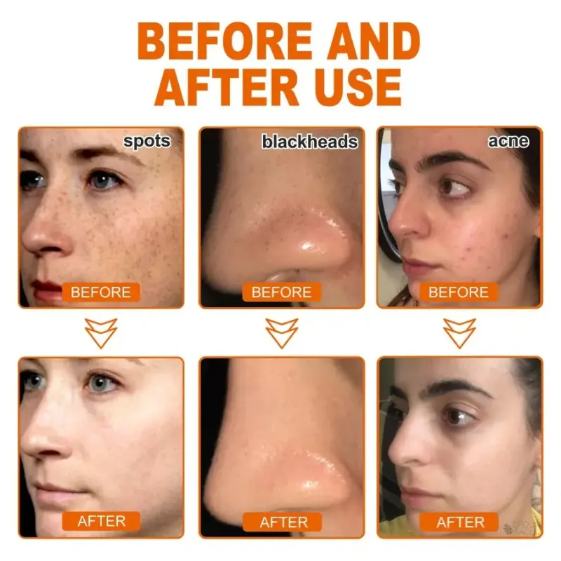 Herbal Peel-Off Mask – Dark Spot Remover & Skin Brightening - TARHUS