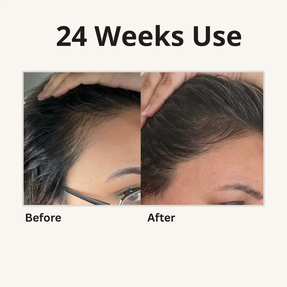 2x 4-in-1 Batana Hair Oil - TARHUS