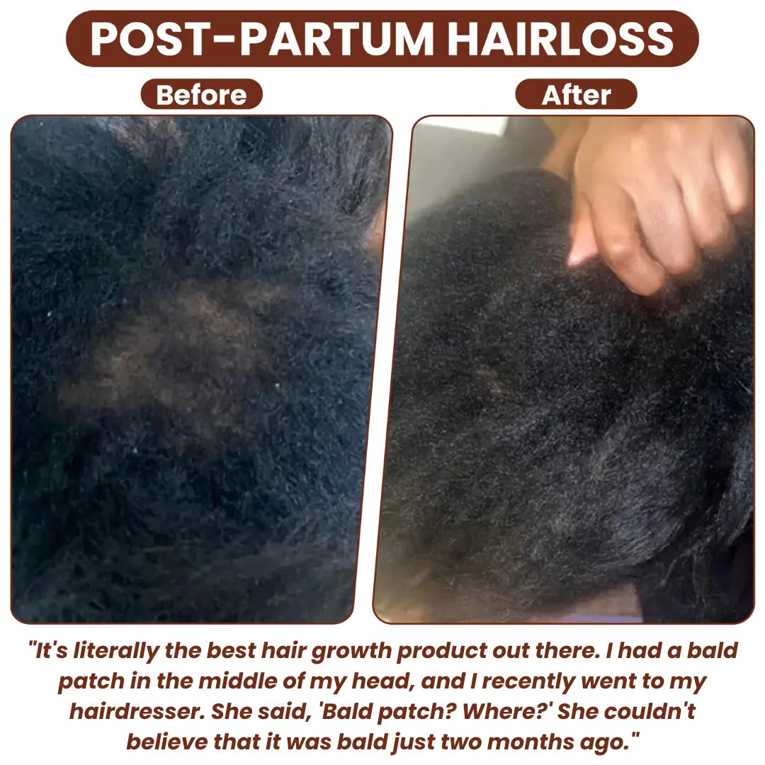 Grows Pure Batana Oil - TARHUS