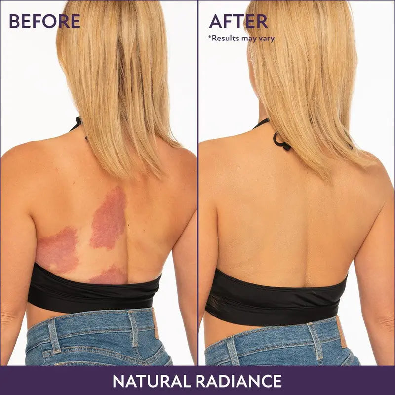 LustraSkin | Body Coverage Perfector – Flawless Radiance Meets Skincare Science TARHUS  Beauty & Personal Care