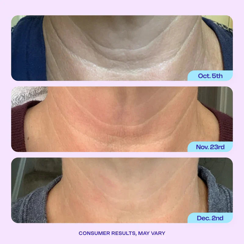 Neck Cream | Tighten & Lift – Visibly Smooth Tech Neck & Sagging Skin TARHUS  Care & Health