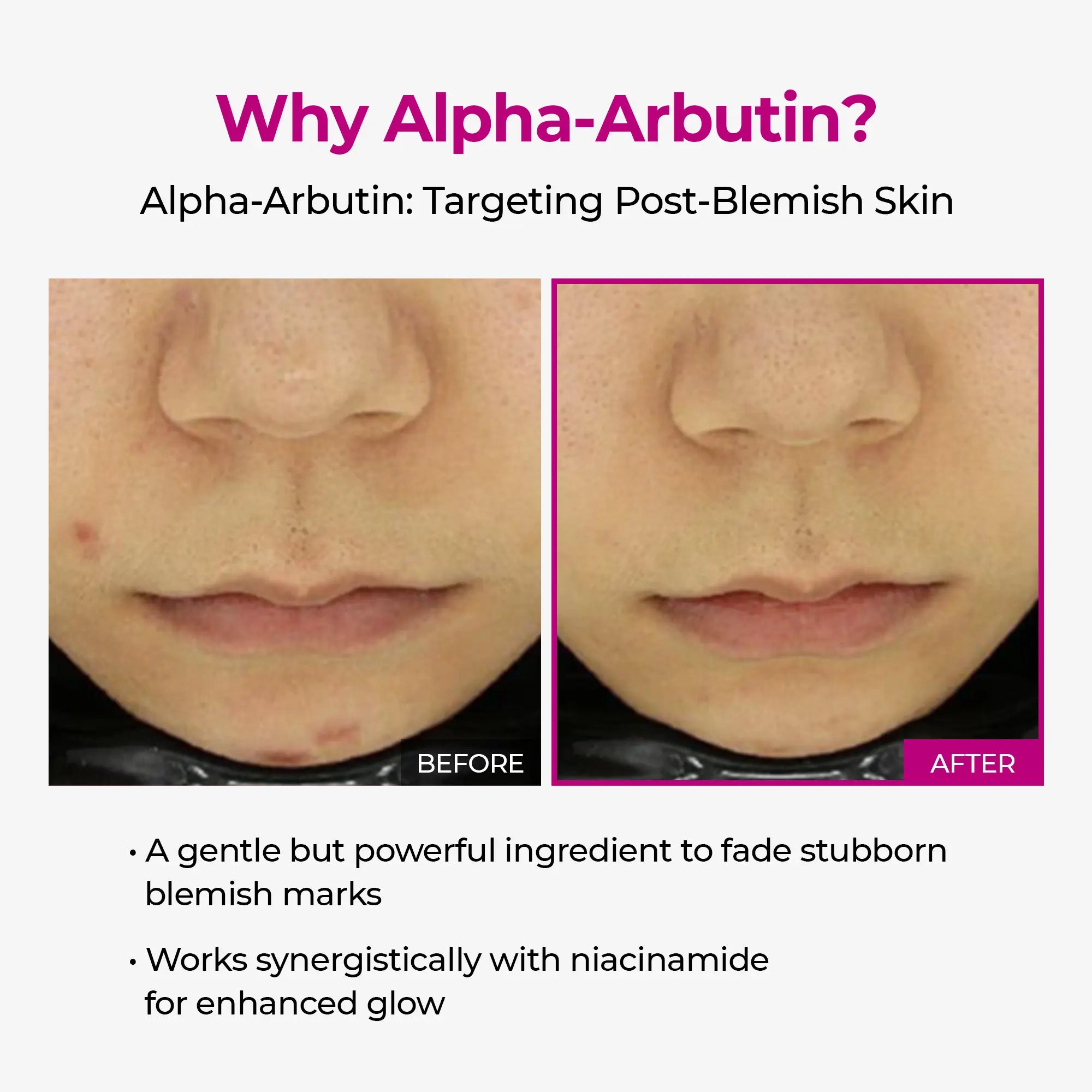 TARHUS | Lumi Pore & Spot Care Duo TARHUS  Care & Health